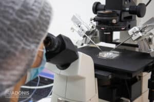 ЭКО (Экстракорпоральное оплодотворение) ЭКО (Экстракорпоральное оплодотворение) в ADONIS, Киев