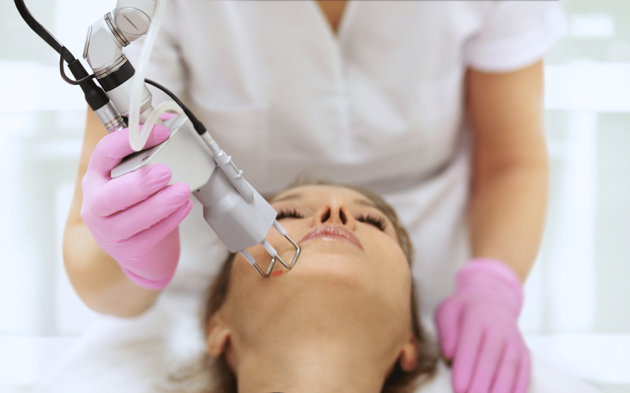 Лазерная шлифовка шрамов и удаление рубцов Лазерная шлифовка шрамов и удаление рубцов