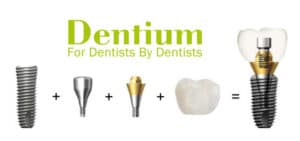 Имплантация зубов Имплантанты