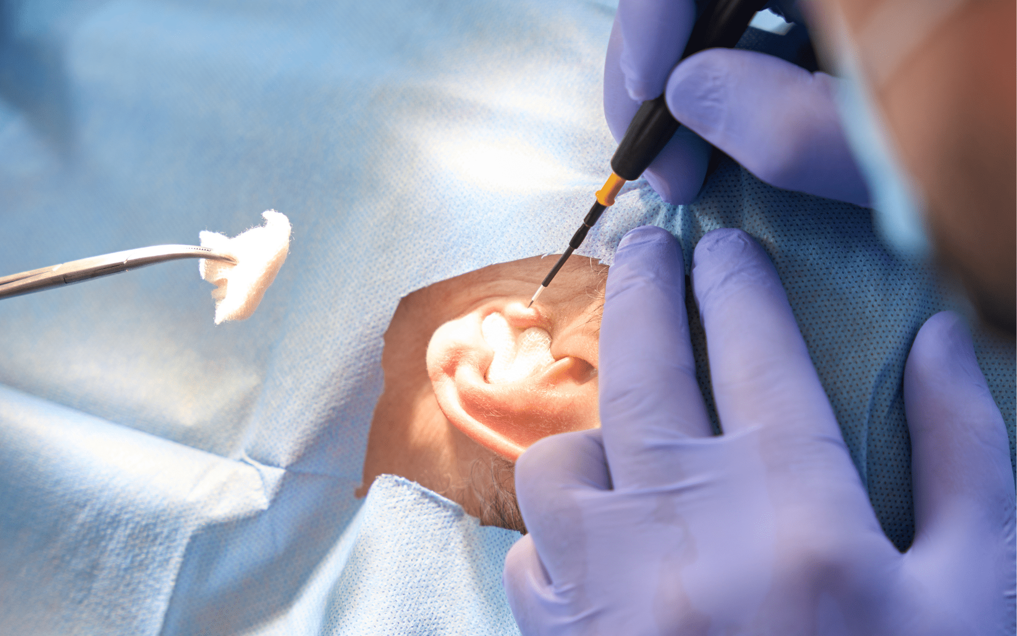 Отопластика (коррекция формы ушей) в Киеве Отопластика (коррекция формы ушей) в Киеве