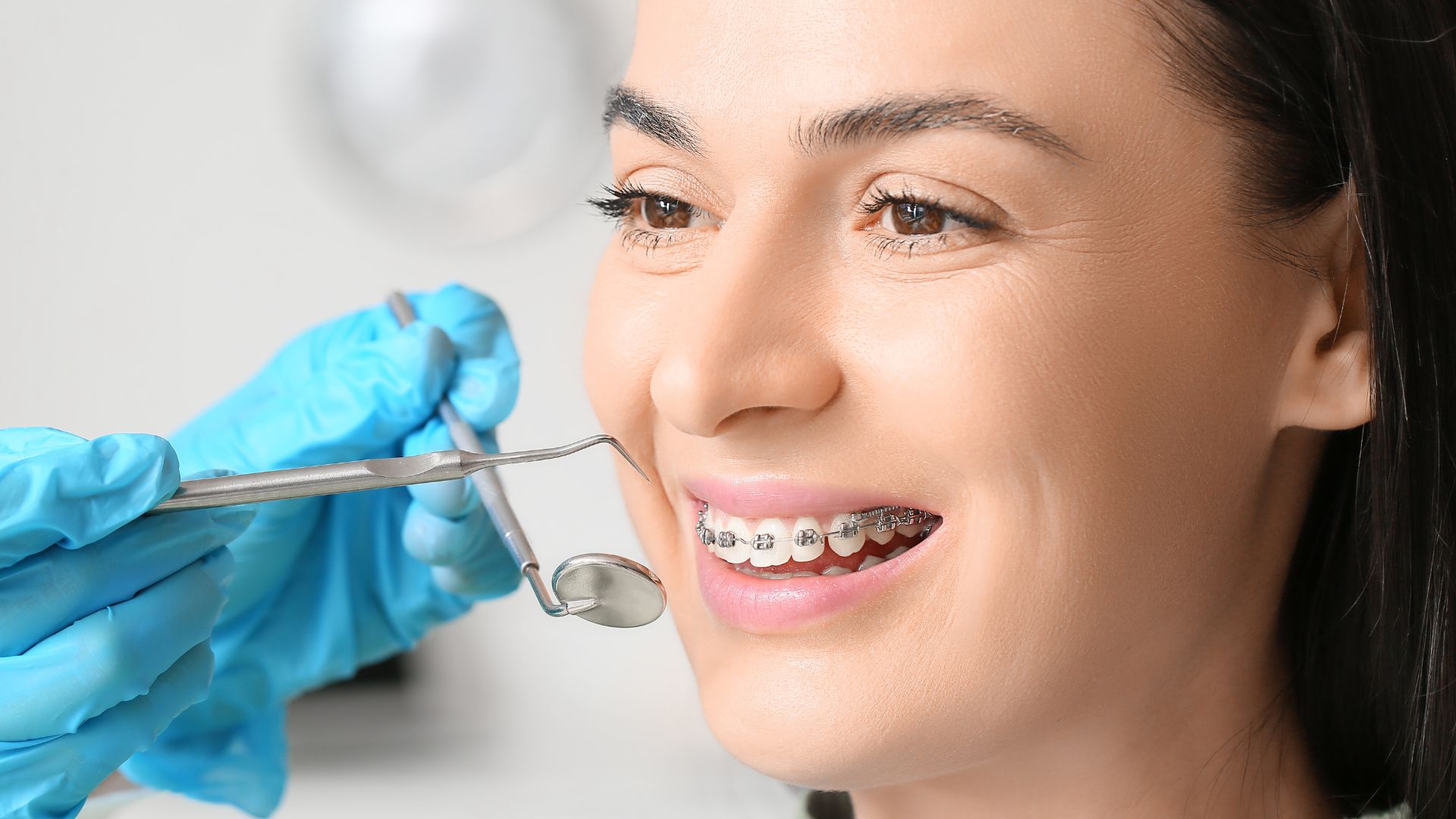 Ортодонтия Услуги ортодонтии ADONIS в Киеве