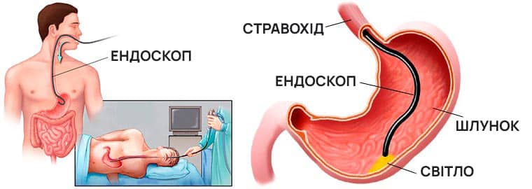 Гастроскопія в Києві Гастроскопія в Києві, в ADONIS