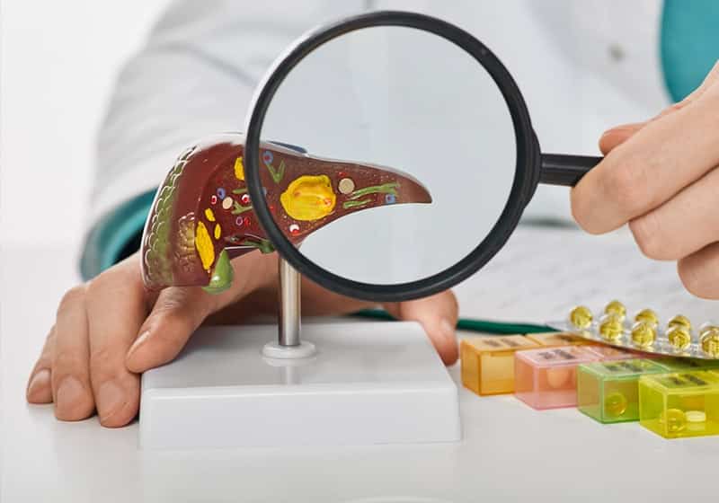 Лечение холецистита в ADONIS | Киев