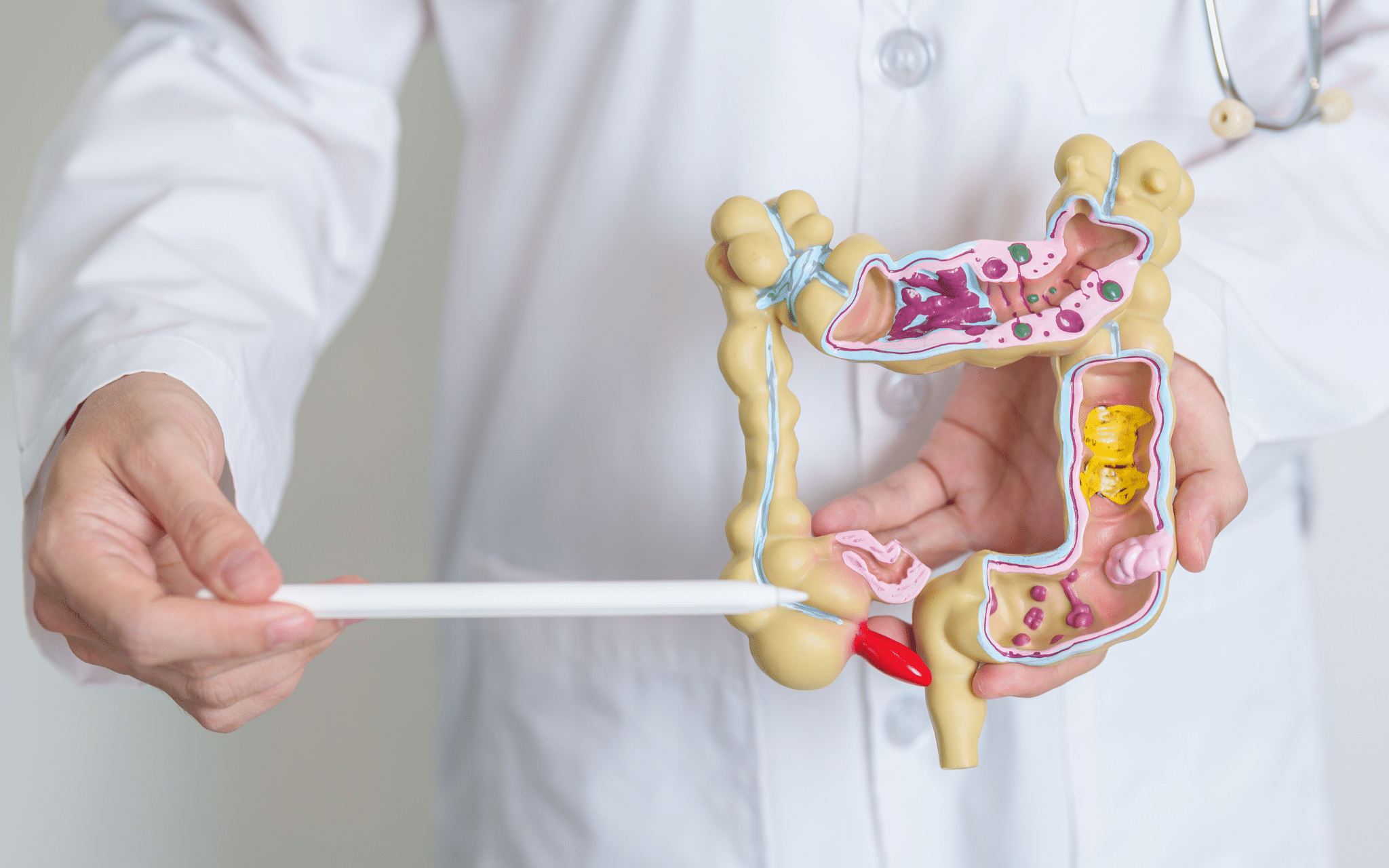 Аппендицит у детей: причины и диагностика Аппендицит у детей: причины и диагностика