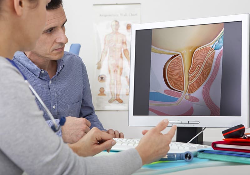 Лечение аденомы простаты в Киеве ADONIS