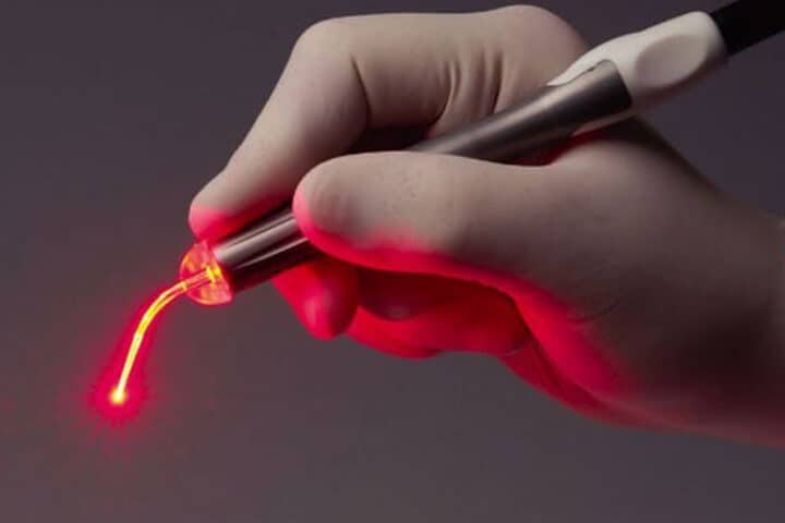 Лечение лазером в Киеве, МЦ ADONIS