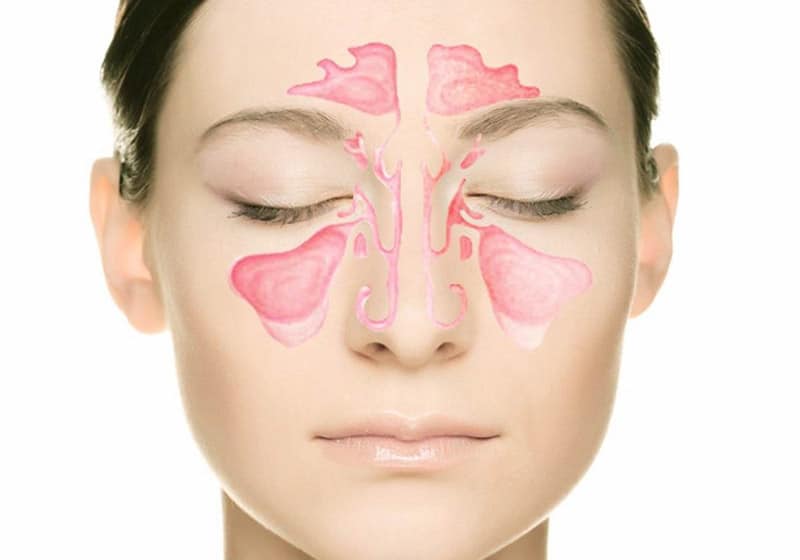 Лечение гайморита в Киеве в ADONIS