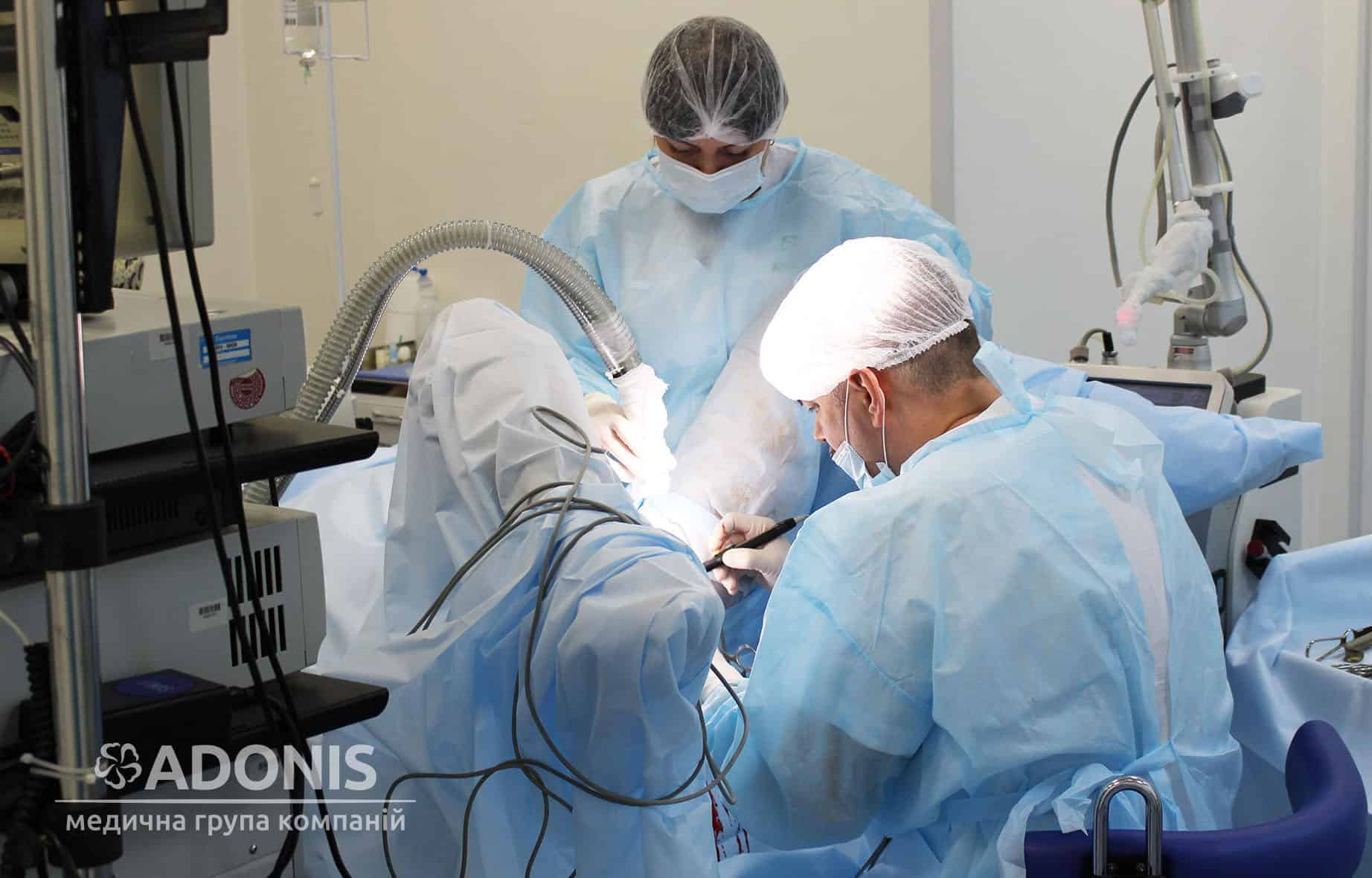 Перинеопластика в Киеве Перинеопластика в Киеве