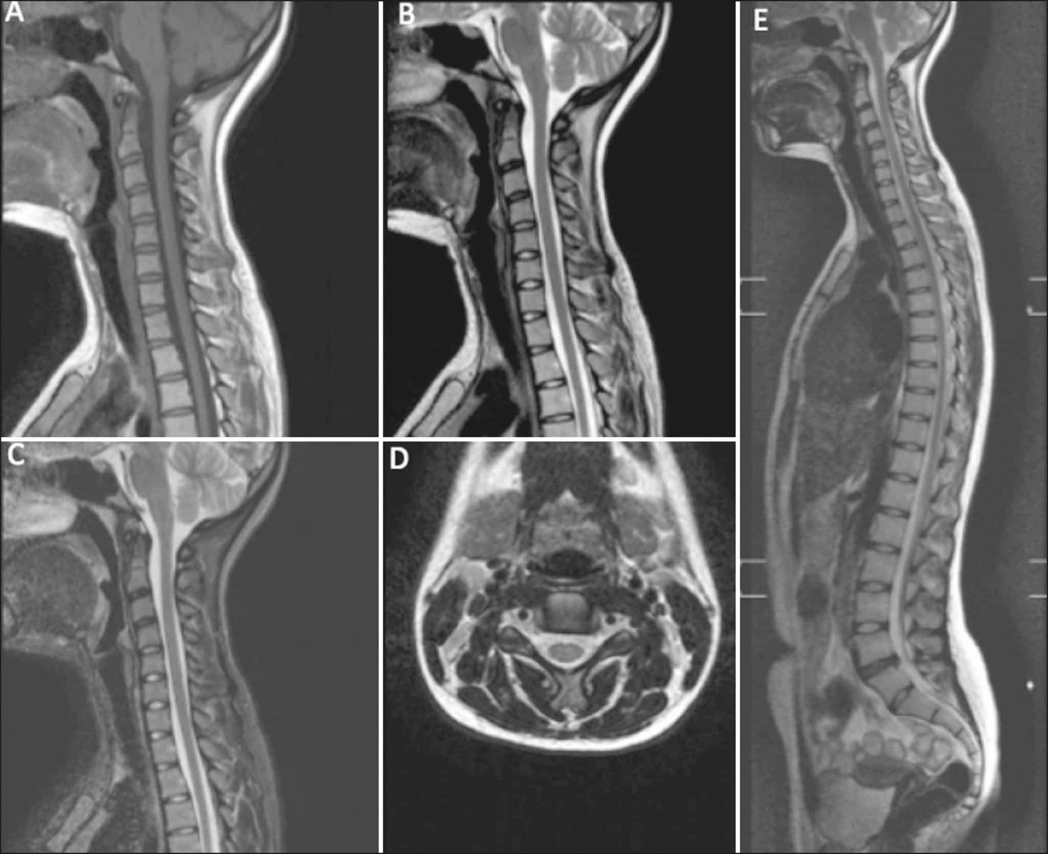 МРТ позвоночника в Киеве