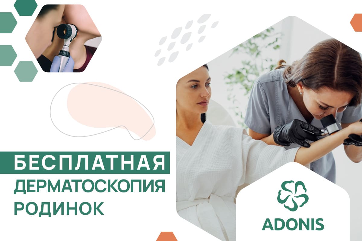 Акция ADONIS – Бесплатная дерматоскопия родинок | Киев