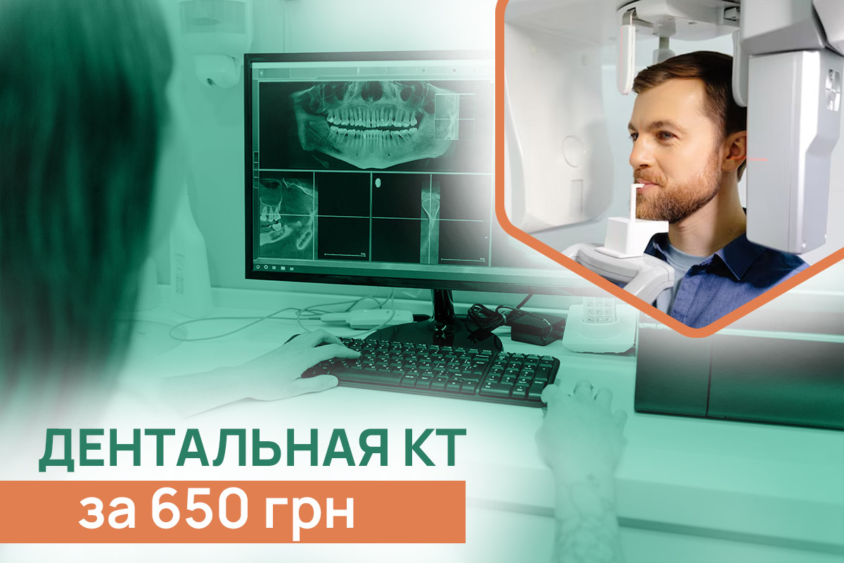 Дентальная КТ за 650 грн. Лучшие врачи, Киев | ADONIS