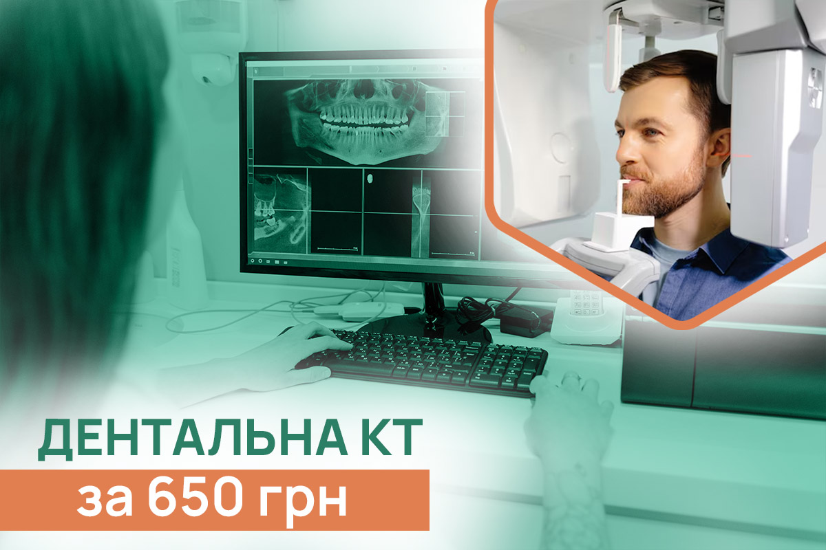 Дентальна КТ за 650 грн. Кращі лікарі | ADONIS | Київ