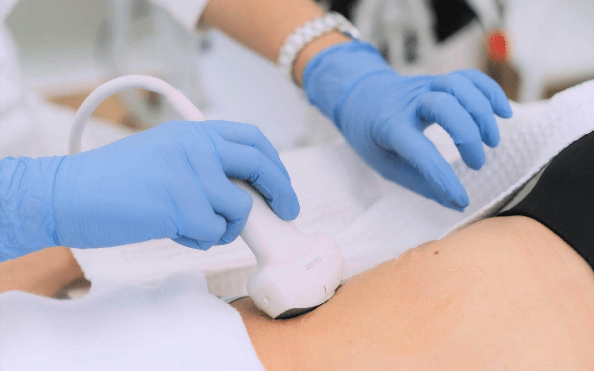 TVT-О операция в Киеве TVT-О операция в Киеве