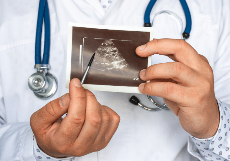 Лечение поликистоза яичников в Киеве Лечение поликистоза яичников в Киеве