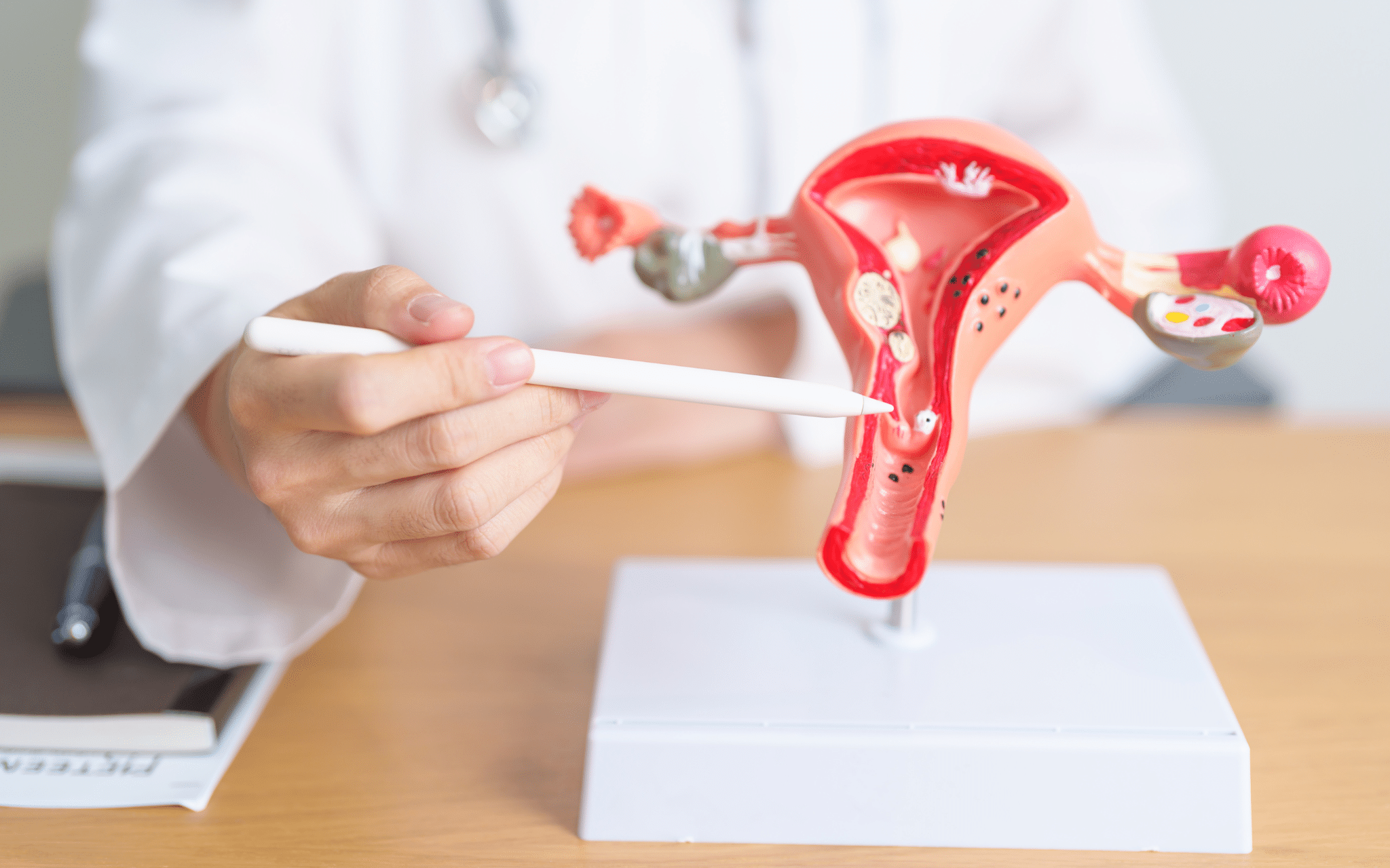 Что такое эндометриоз - симптомы и методы лечения Что такое эндометриоз - симптомы и методы лечения