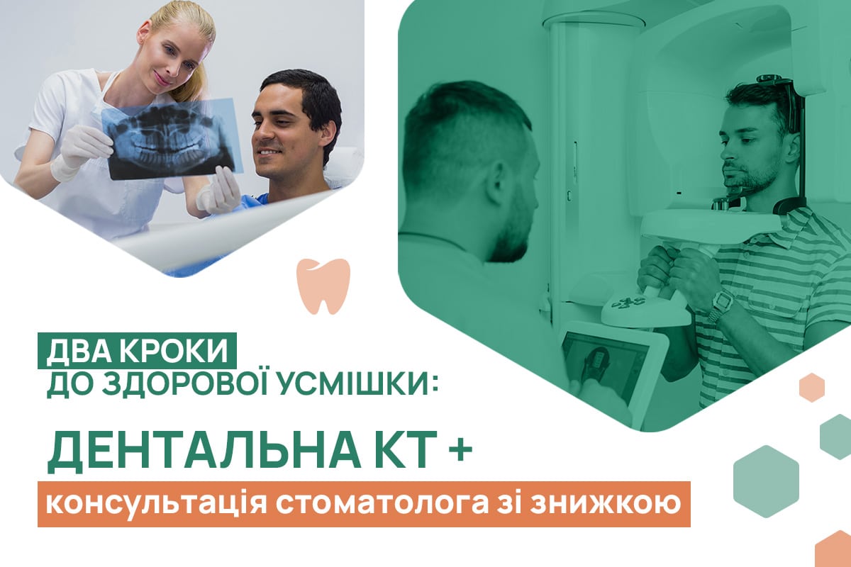 КТ дентальна та Консультація стоматолога | Акції та знижки ADONIS | Київ