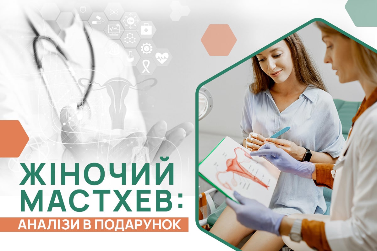 Акція Жіночий мастхев – Аналізи в подарунок – ADONIS | Київ
