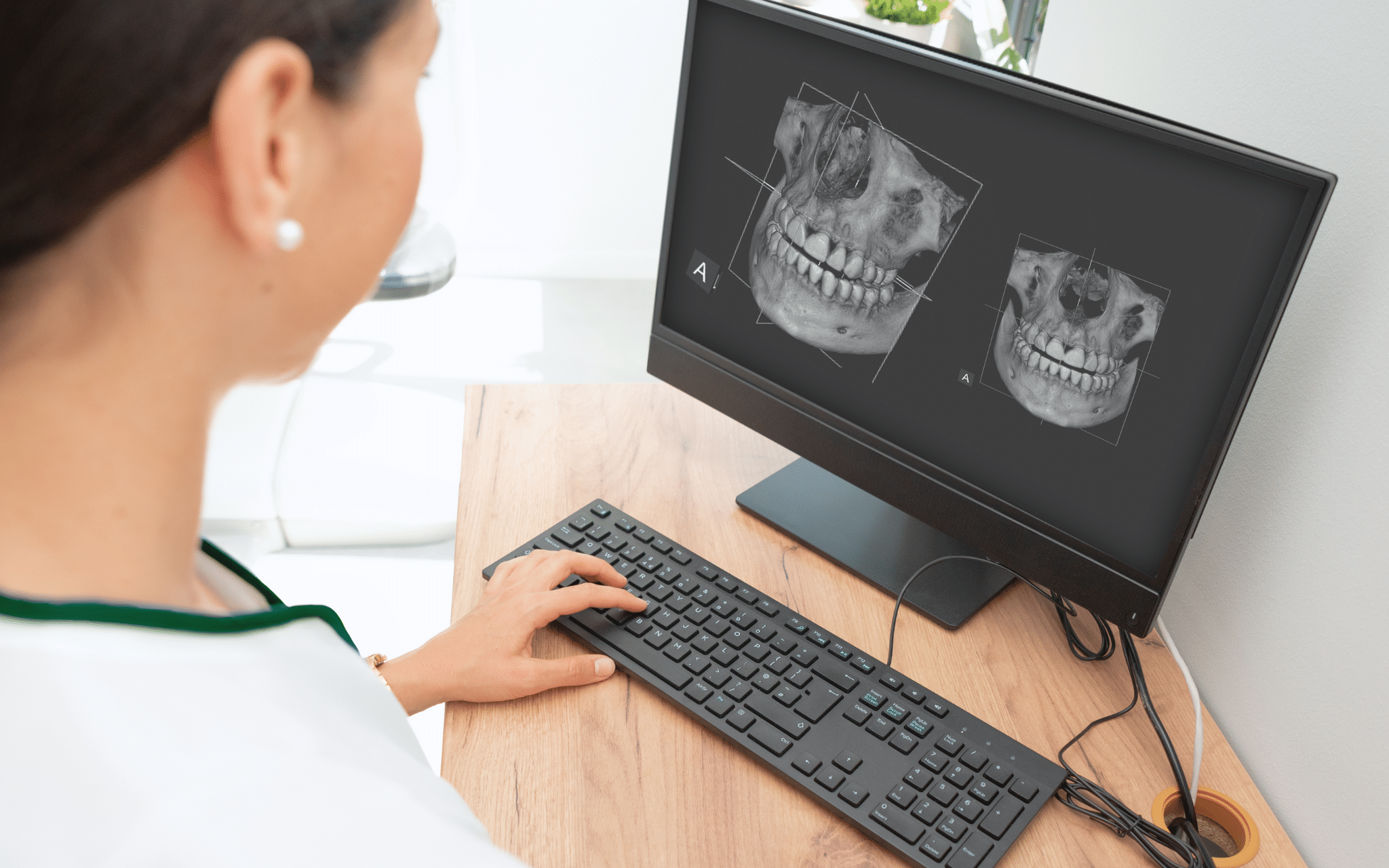 КТ зубов и челюсти в Киеве КТ зубов и челюсти в Киеве