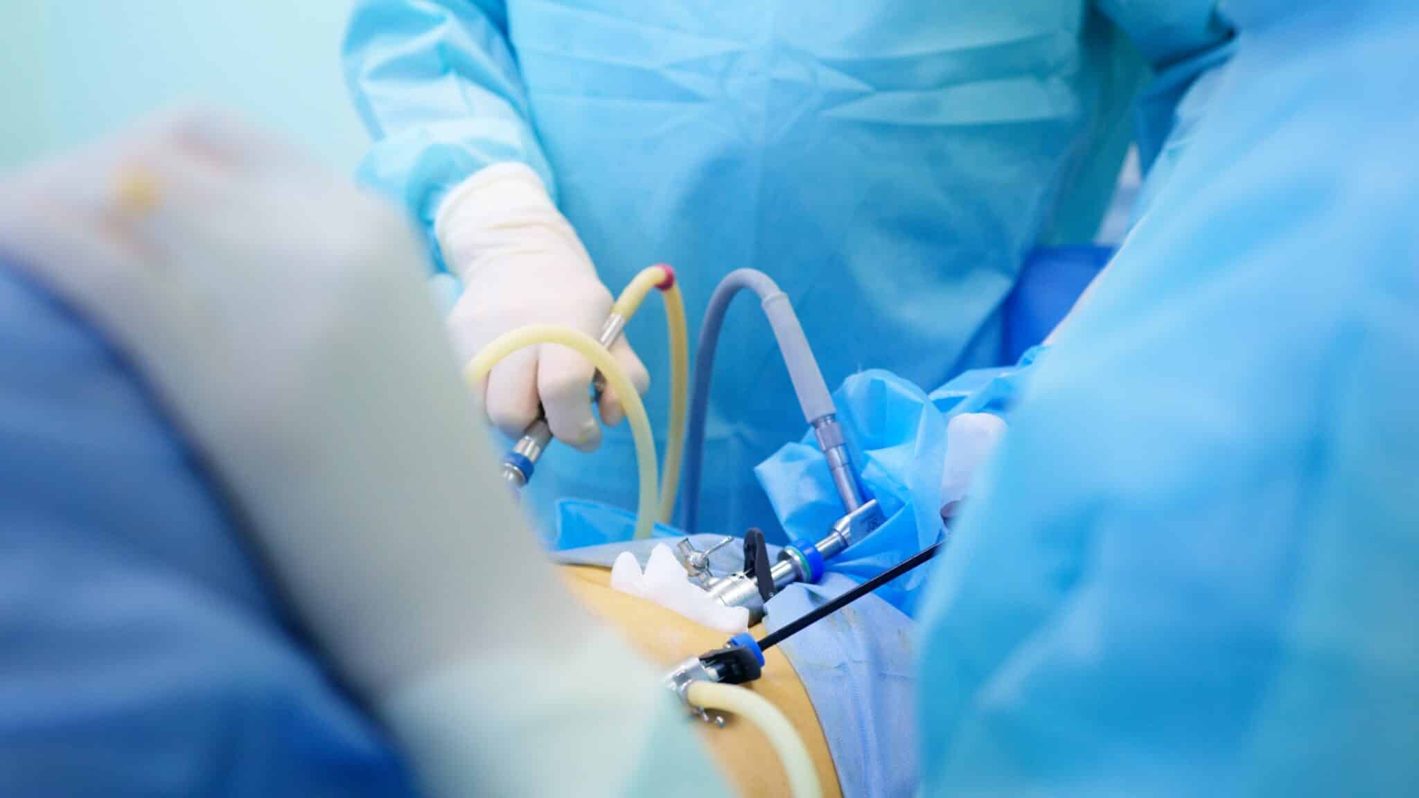 Операция на яичниках: удаление кист, резекция яичников, овариоэктомия Ход овариоэктомии