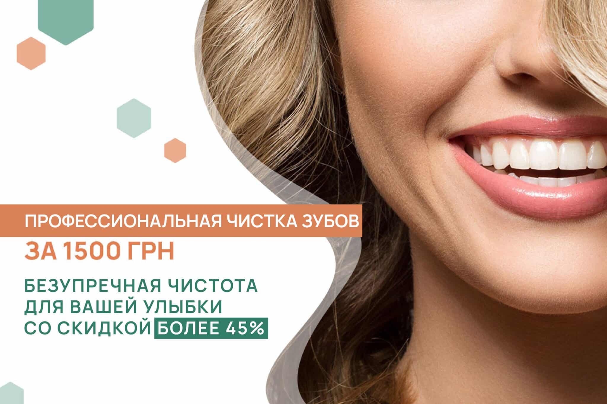 Чистка зубов со скидкой более 45 %, ADONIS | Киев