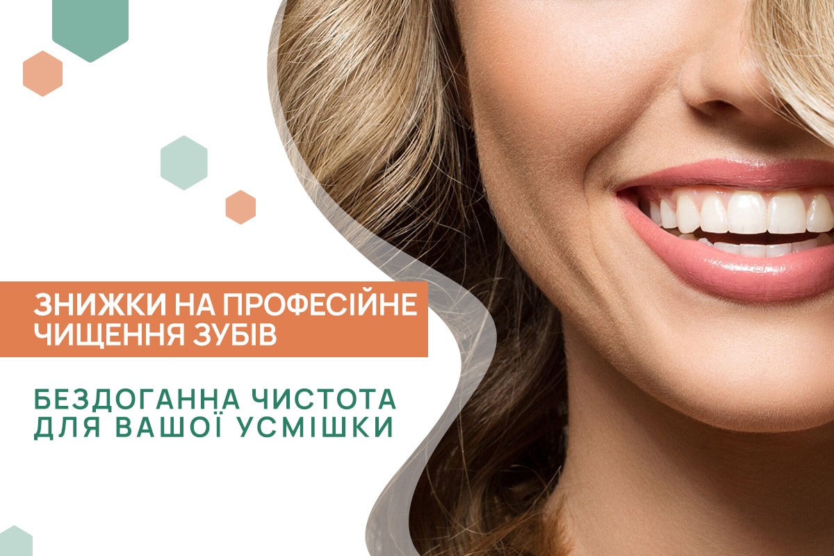 Спецціна на професійне чищення зубів – ADONIS | Київ