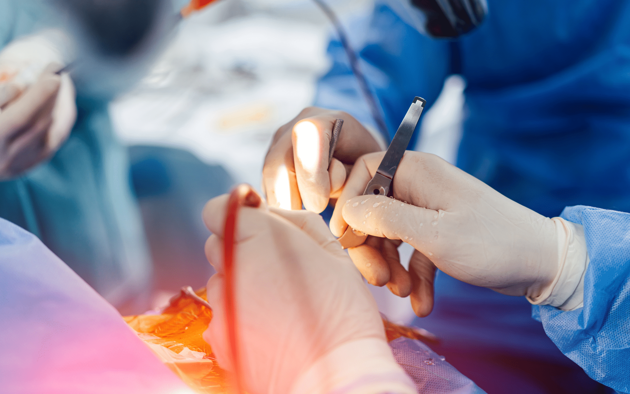 Хирургическое лечение рака Хирургическое лечение рака