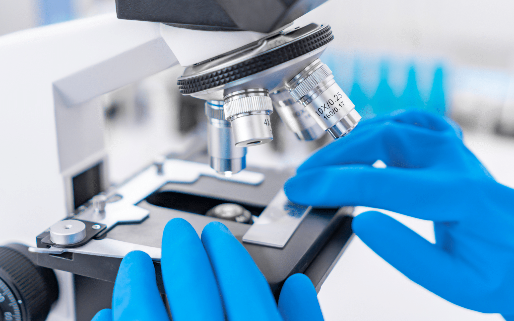 Рак шийки матки Рак шийки матки