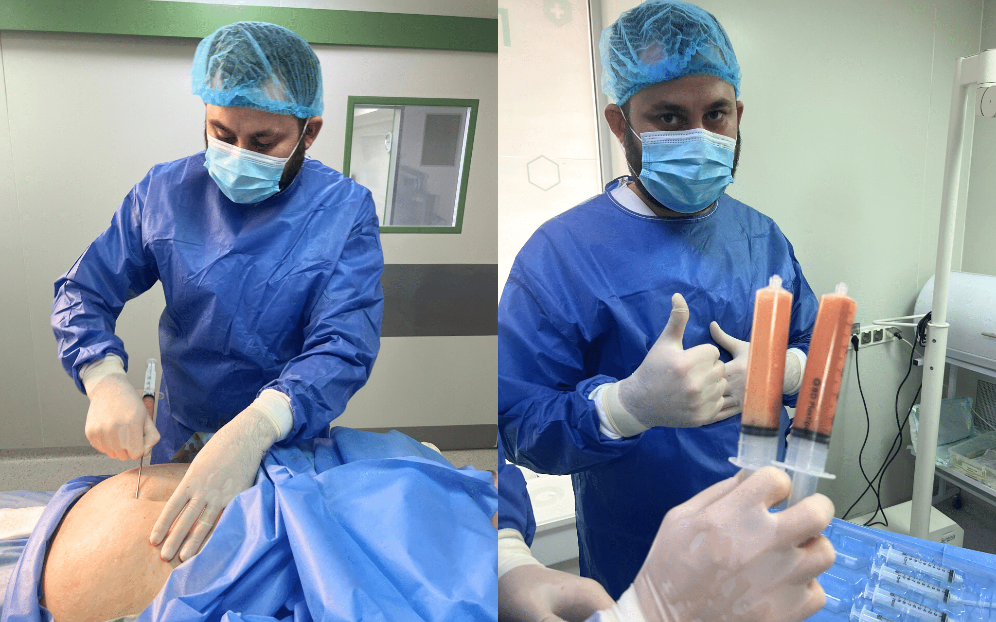 SVF-терапия в Киеве SVF-терапия в Киеве