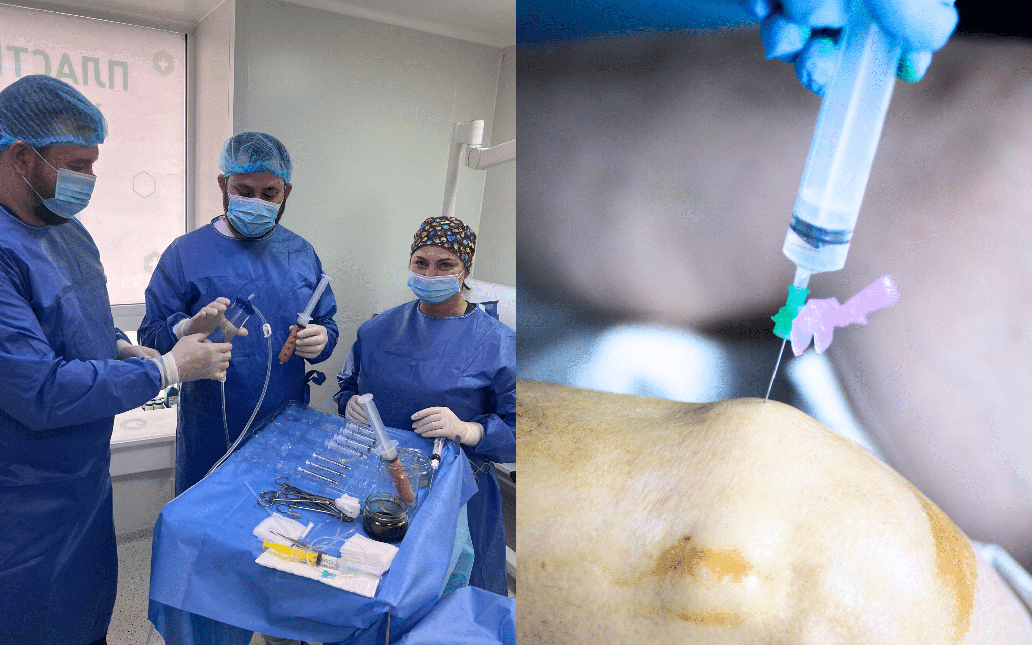 SVF-терапия в Киеве SVF-терапия в Киеве