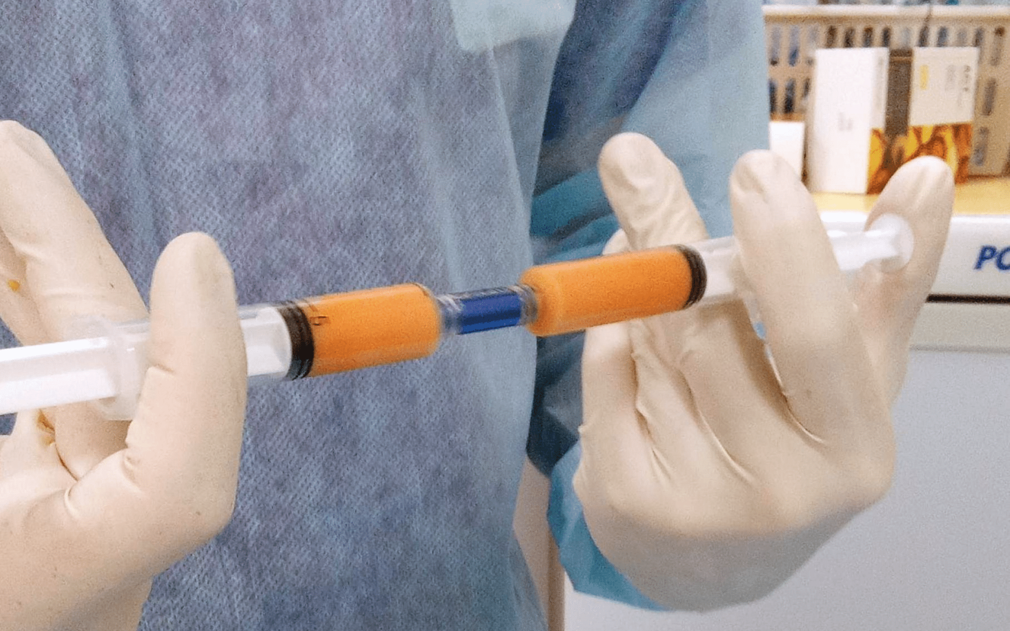 SVF-терапия в Киеве SVF-терапия в Киеве