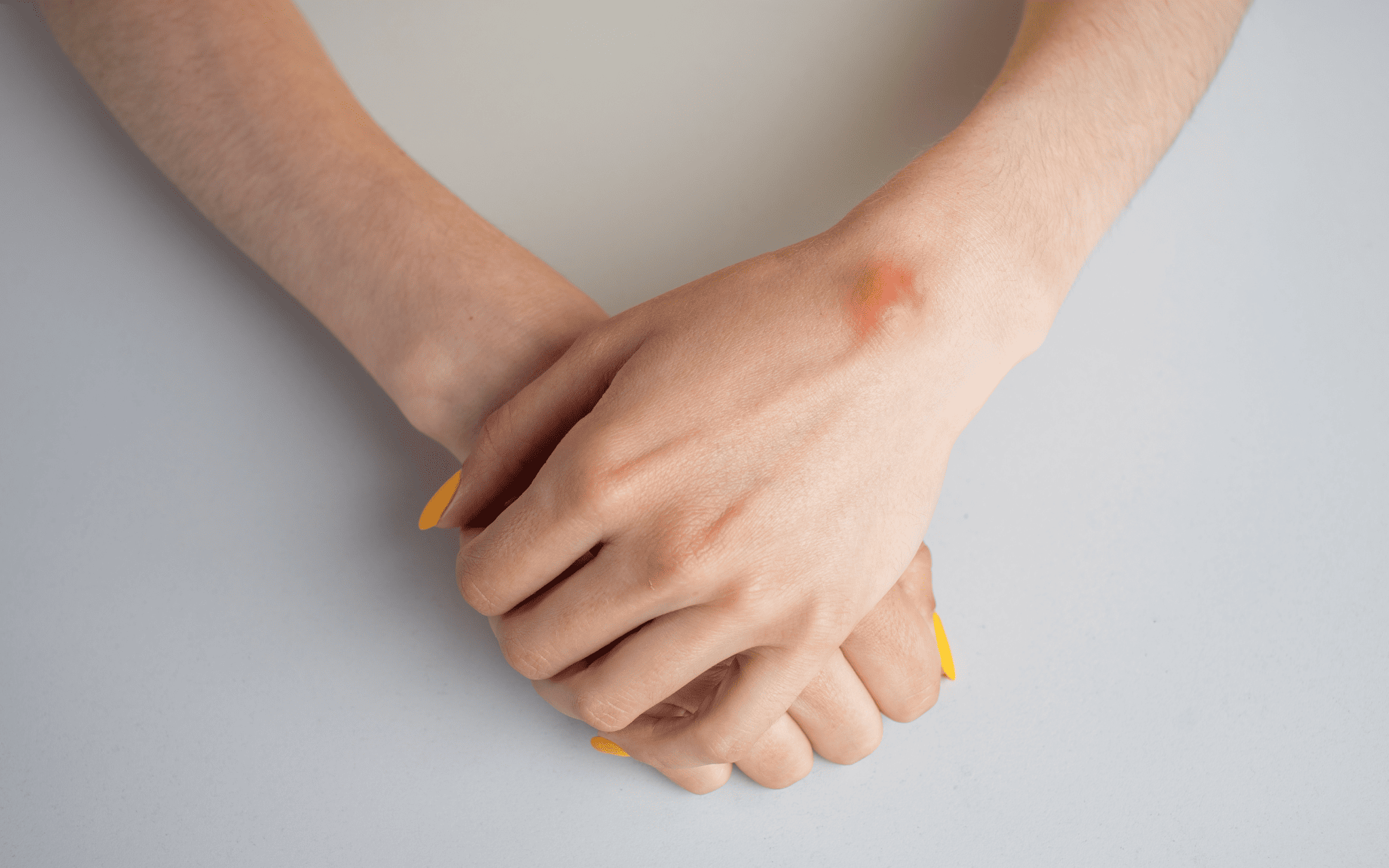 Хирургия кисти в Киеве Хирургия кисти в Киеве