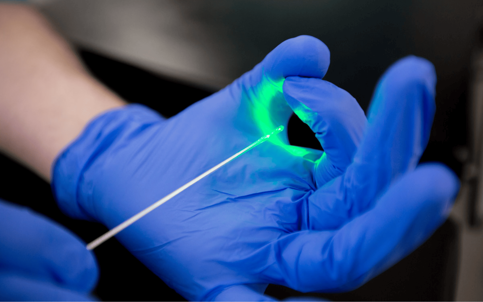 Лазерное удаление геморроя в Киеве Лазерное удаление геморроя в Киеве