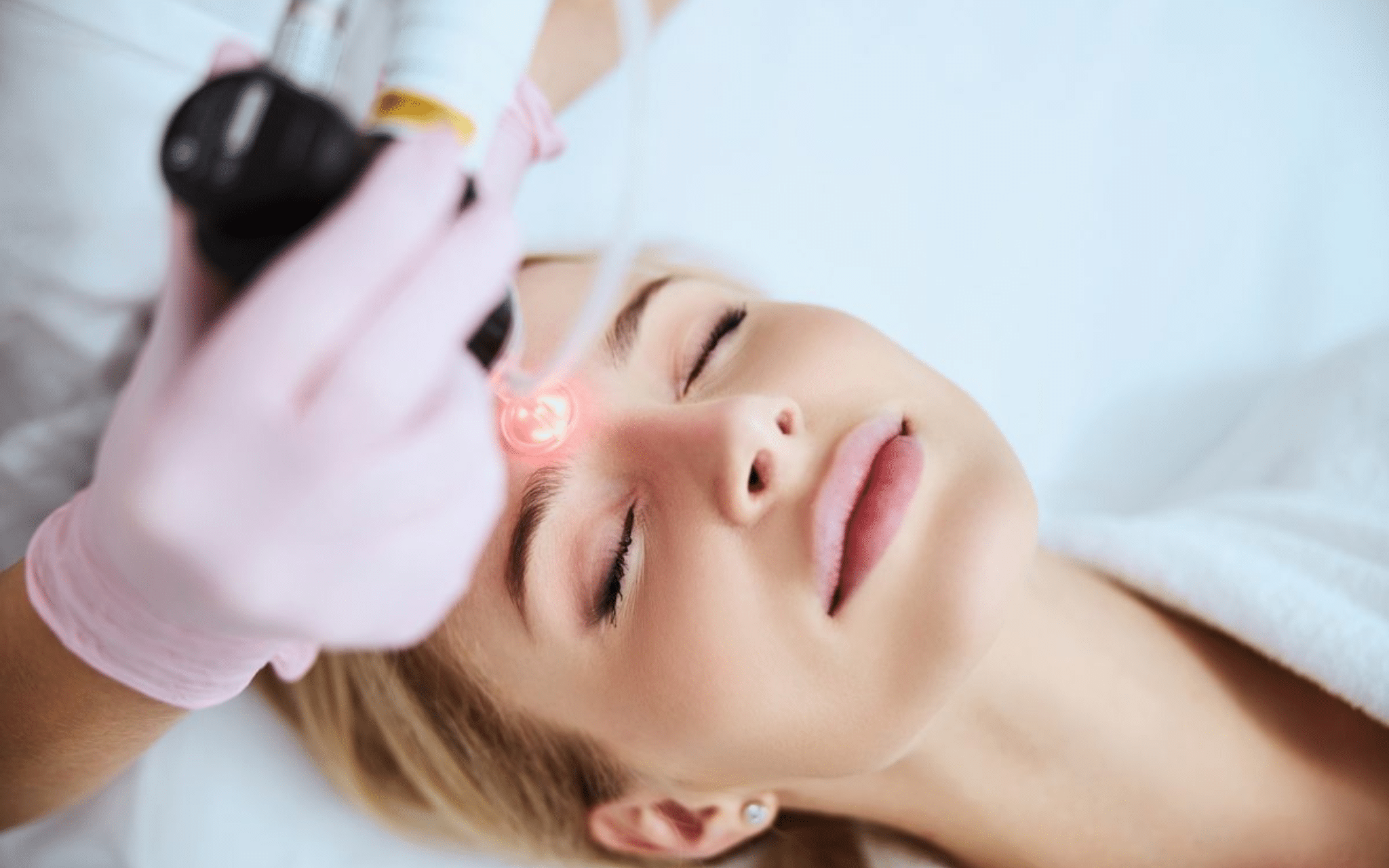 Лазерная шлифовка постакне Лазерная шлифовка постакне