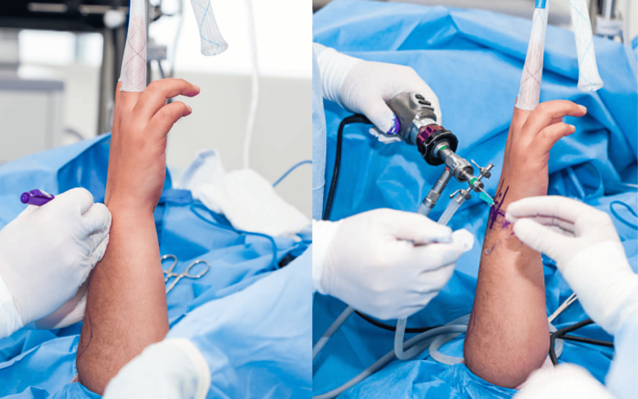 Хирургия кисти в Киеве Хирургия кисти в Киеве