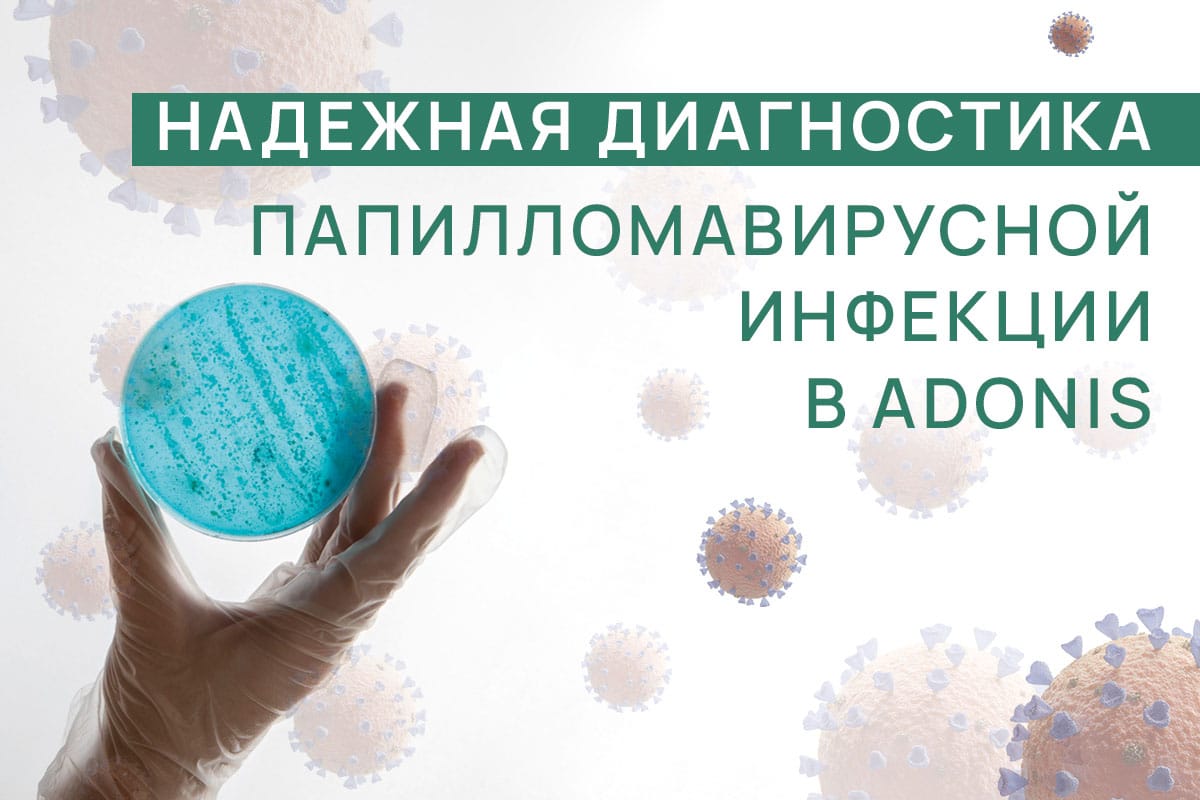 Новина_Надійна діагностика_РУС Новина_Надійна діагностика_РУС