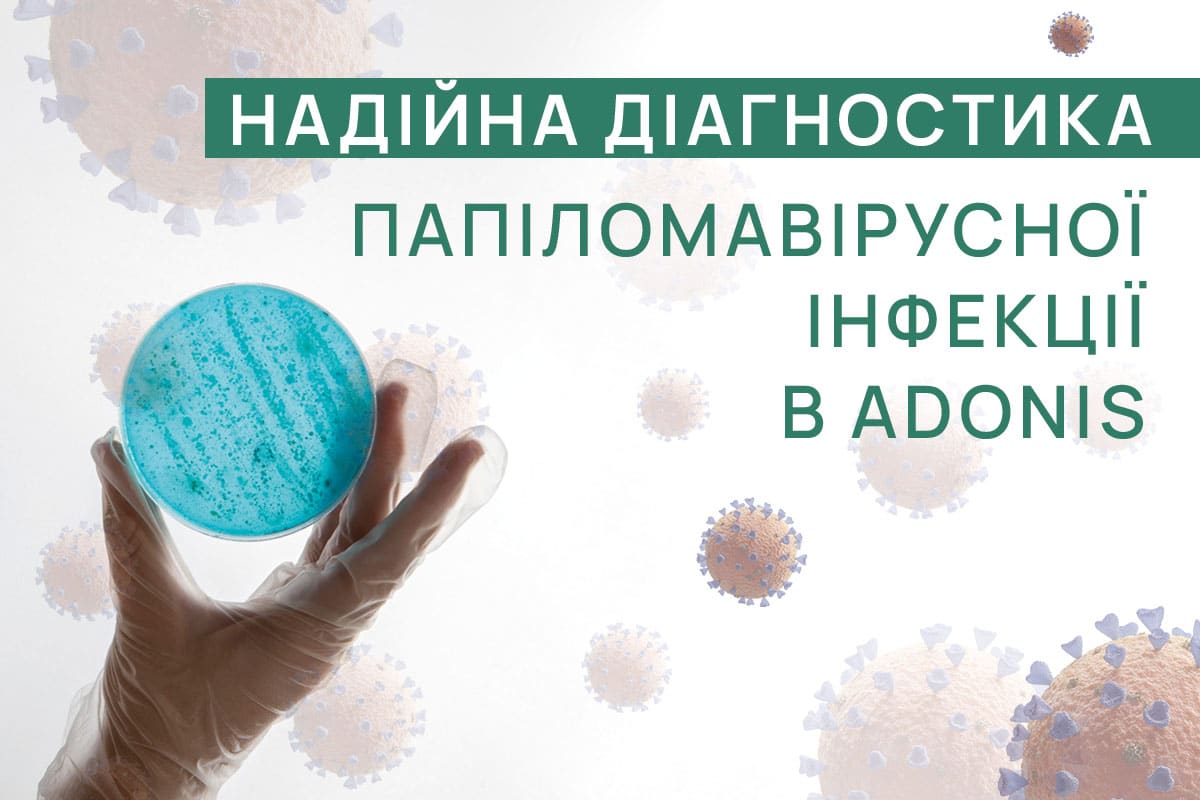 Новина_Надійна діагностика_УКР Новина_Надійна діагностика_УКР