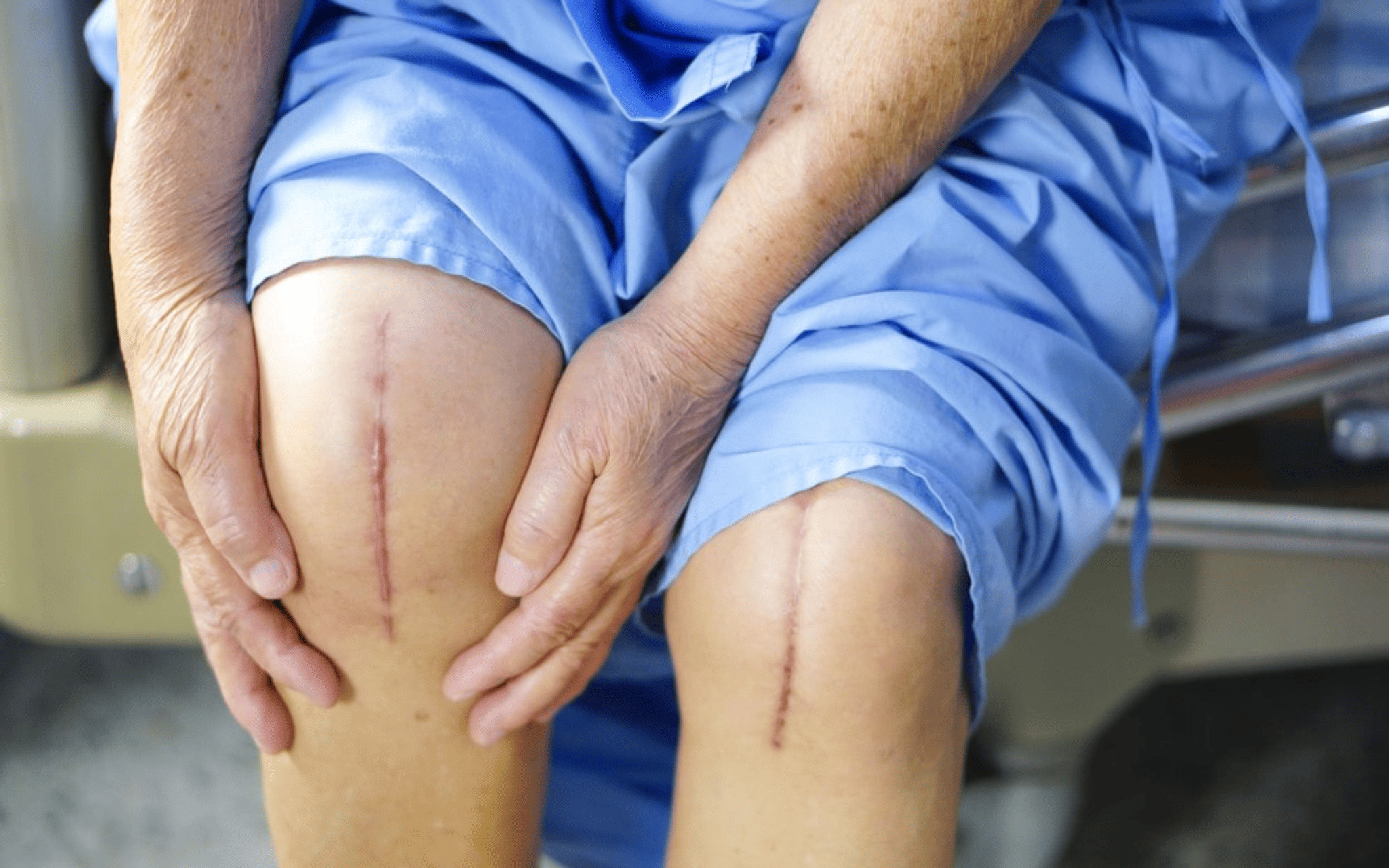 Эндопротезирование коленного сустава в Киеве Эндопротезирование коленного сустава в Киеве