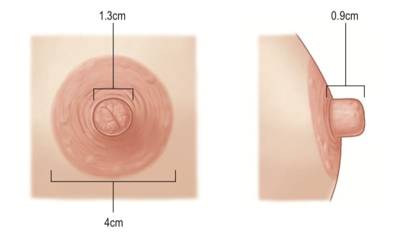 Коррекция сосков и ареолы I категории сложности Виды коррекции соска и ареолы