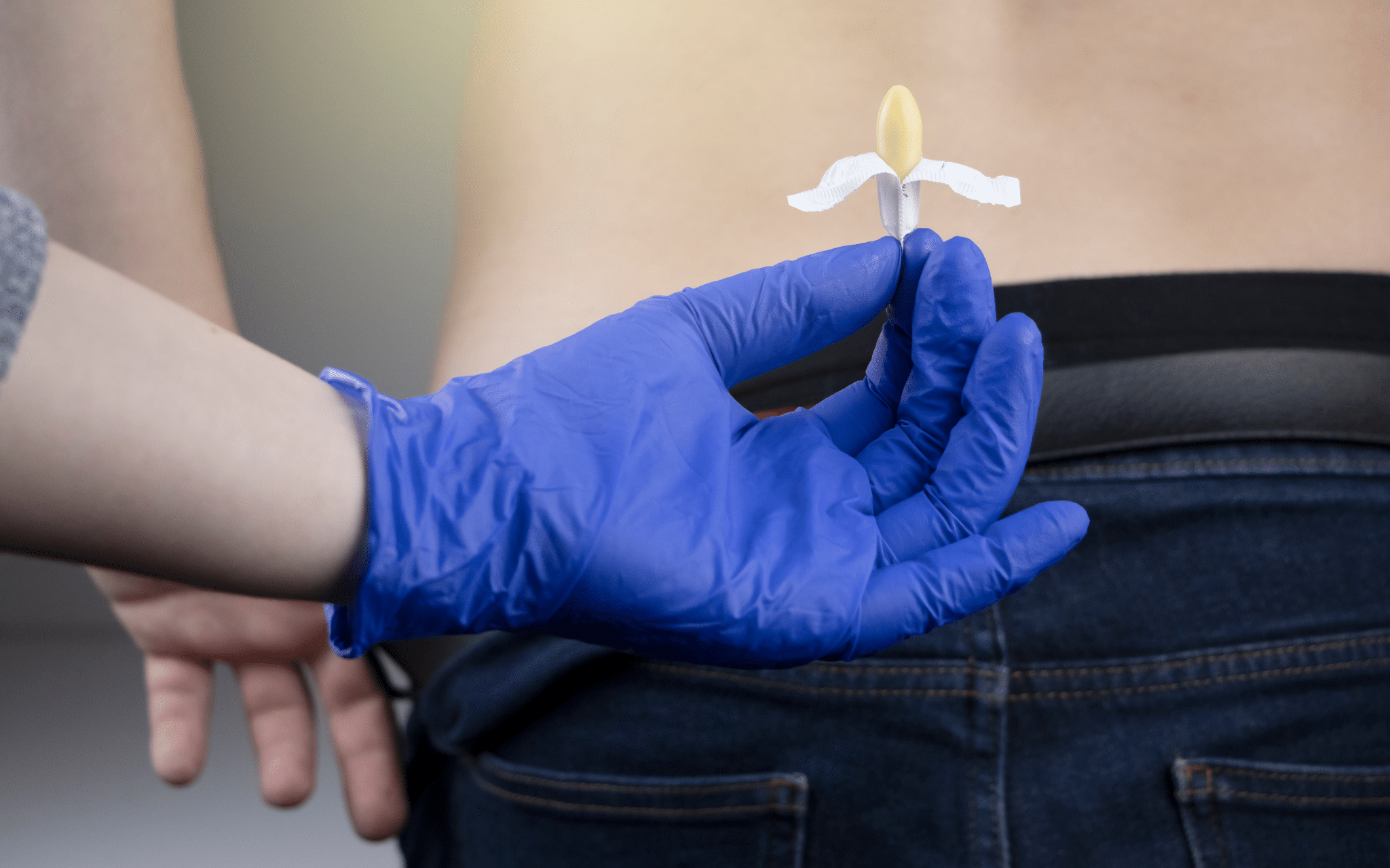 Лечение внутреннего геморроя в Киеве Лечение внутреннего геморроя в Киеве