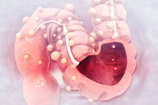 Электрокоагуляция полипов в Киеве электрокоагуляция полипов ЖКТ в ADONIS, Киев