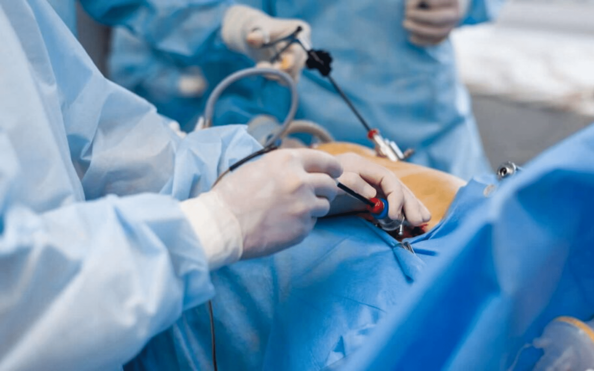 Нефрэктомия (удаление почки) в Киеве Нефрэктомия (удаление почки) в Киеве