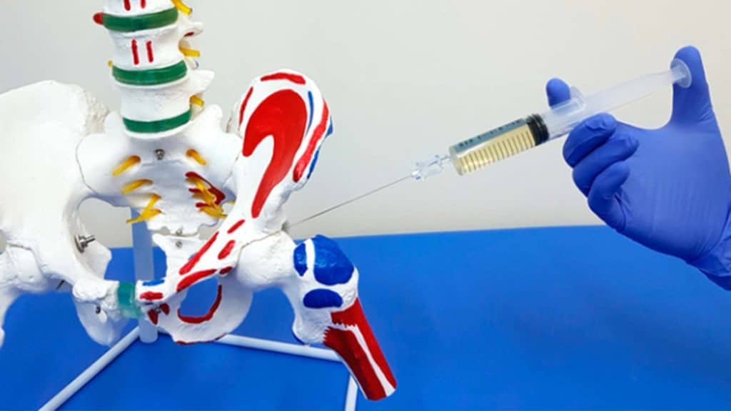 Що таке екзосоми для суглобів і як вони допомагають у лікуванні Как проходит процедура экзосомальной терапии в ADONIS