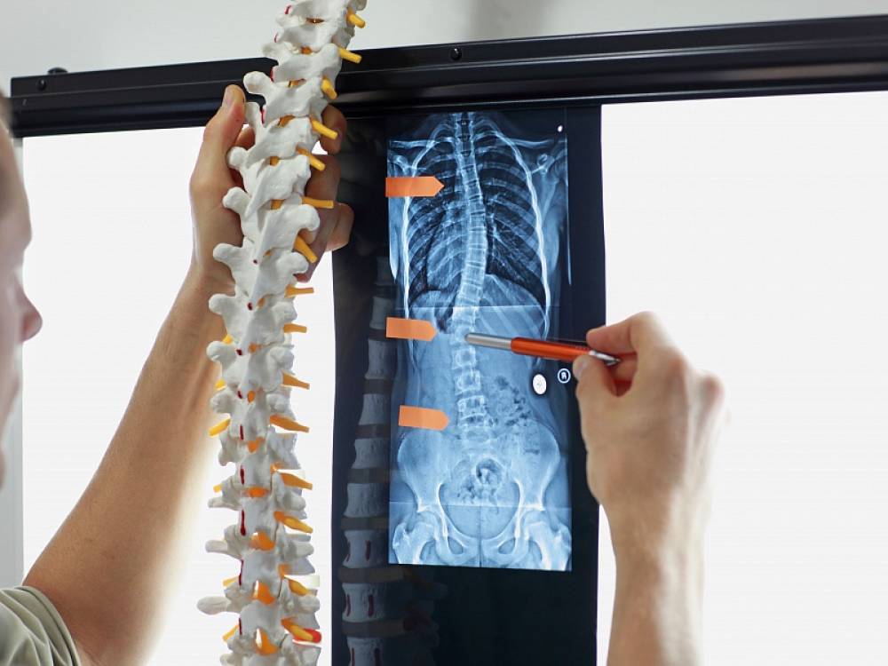 Лікування сколіозу в Києві Діагностика та методи лікування сколіозу