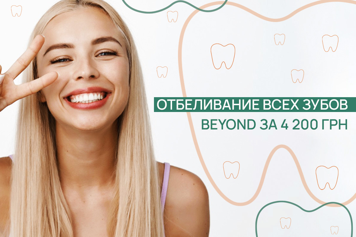 Отбеливание зубов Beyond – ADONIS | Киев