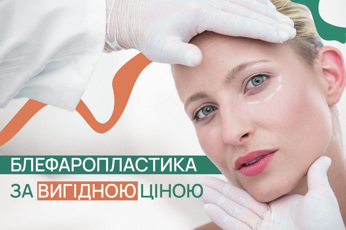 Вартість послуг МЦ ADONIS Перезавантаження погляду