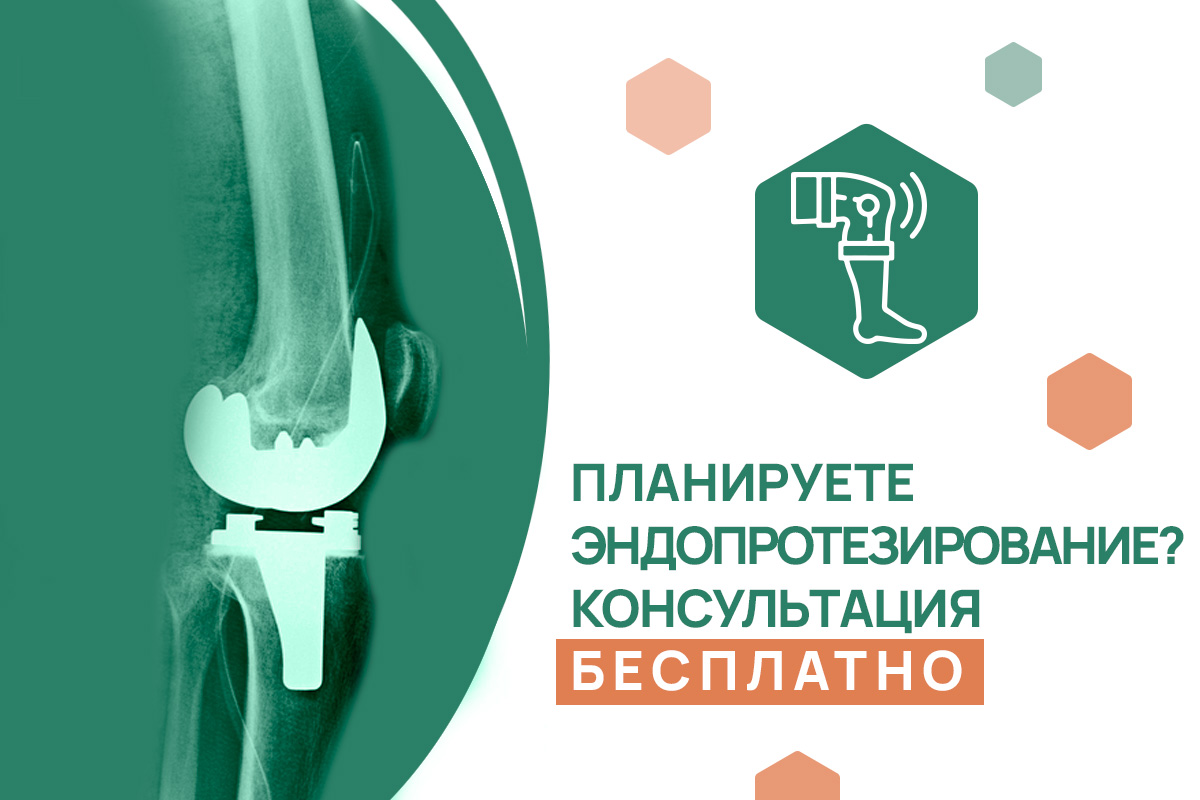 Бесплатная консультация перед эндопротезированием – Акция ADONIS | Киев