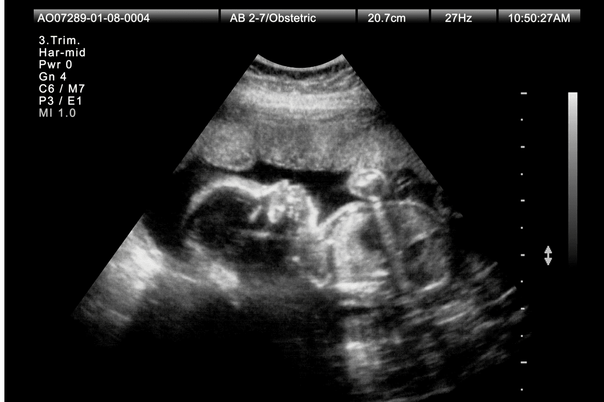 Скрининг 3 триместра беременности в Киеве Скрининг 3 триместра беременности в Киеве