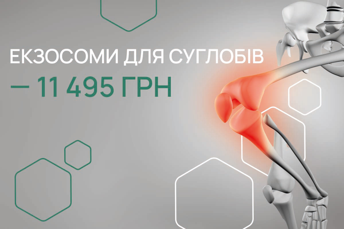 Здорові суглоби — нове життя з екзосомами