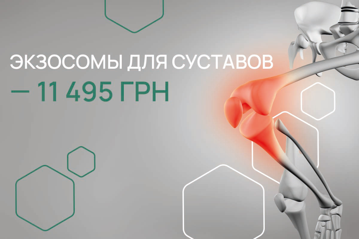 Здоровые суставы - новая жизнь с экзосомами в Киеве