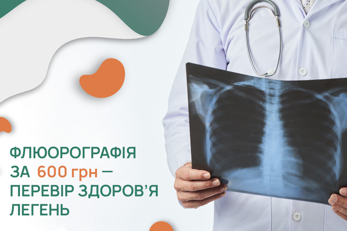 Флюорографія за  600 грн — перевір здоров’я легень
